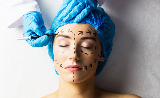 Facelift Surgery